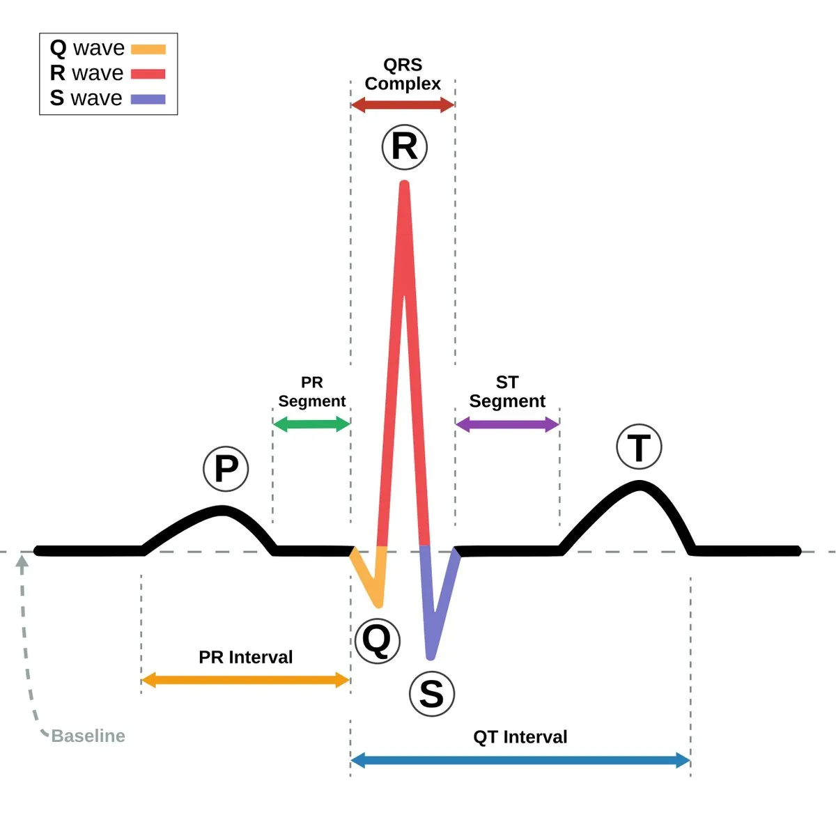Schéma d’un battement cardiaque sur un ECG, avec l’onde P, le complexe QRS, l’onde T et les intervalles PR et QT.