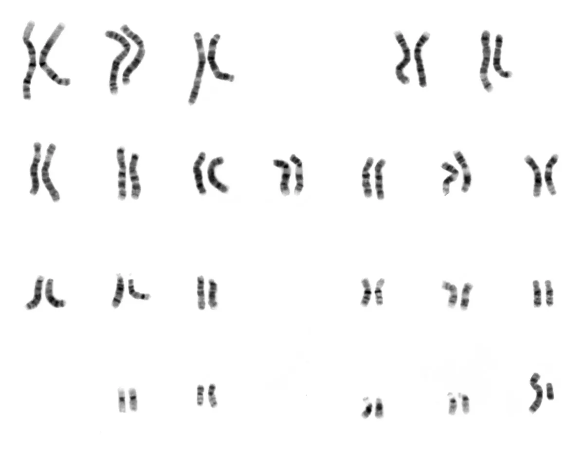 Chromosomes humains classés par paires de 1 à 22, puis X et Y.